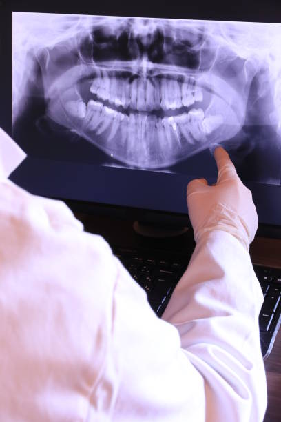 Best Emergency Wisdom Teeth Removal in Chalfant, CA