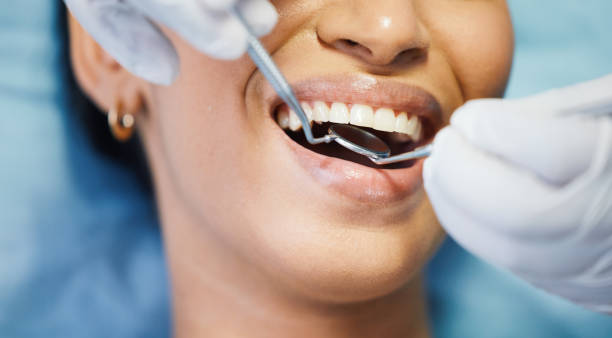 Best Emergency Treatment for Dental Infections or Abscesses in Chalfant, CA